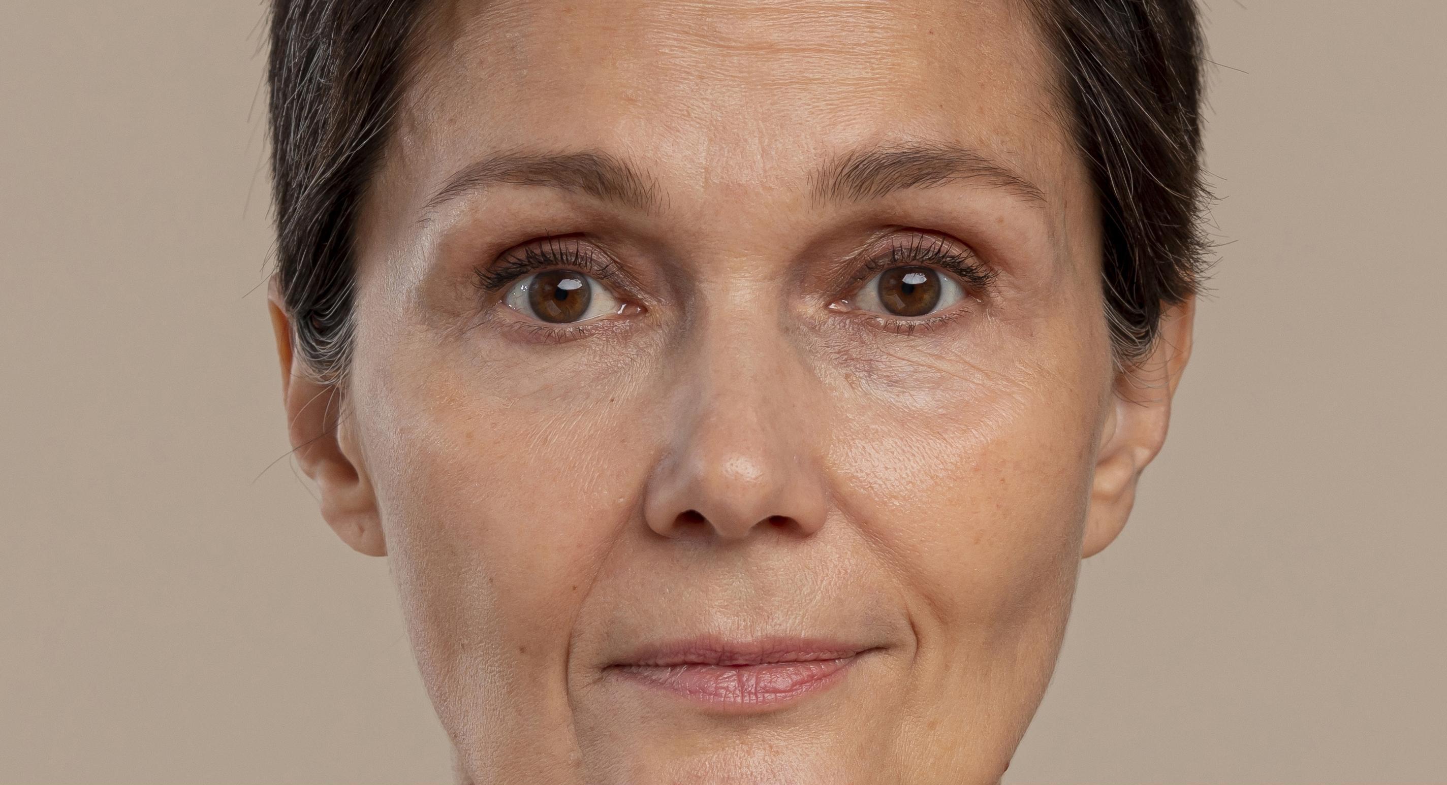 Posle tretmana — prirodan, svež izgled